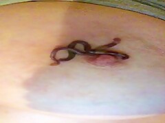 Worm in the nipples